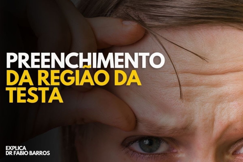 Preenchimento da testa: quando é indicado?