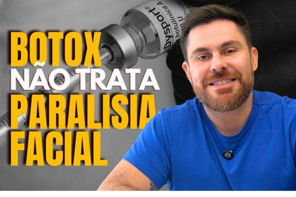 Botox não trata paralisia facial, o que realmente funciona