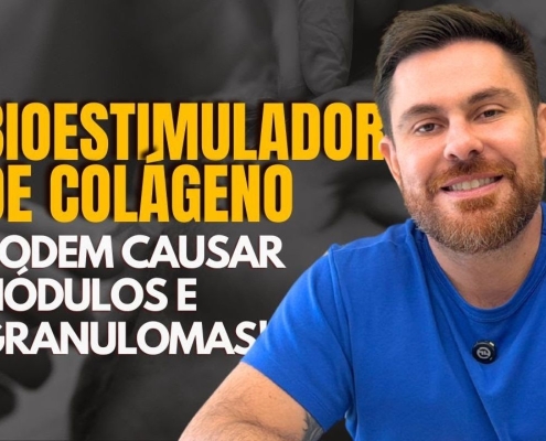 Bioestimuladores de colágeno podem causar nódulos e granulomas?