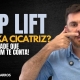 Cirurgia de lip lift deixa cicatriz? A verdade que você precisa saber