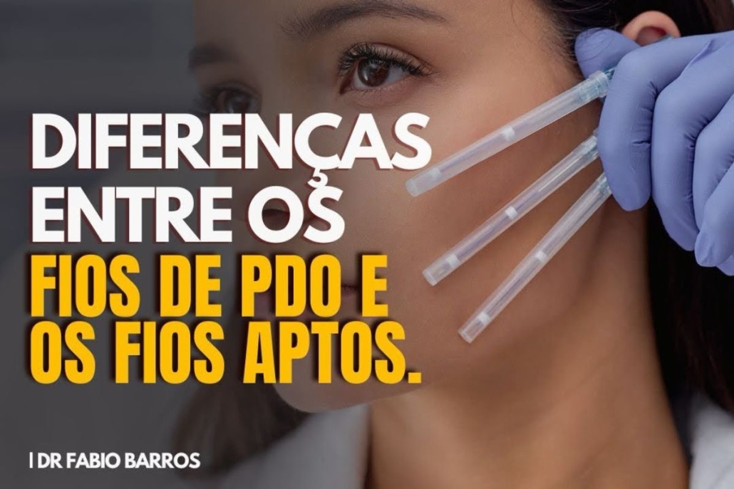 Diferença entre fios de PDO e fios Aptos: qual escolher para lifting facial?