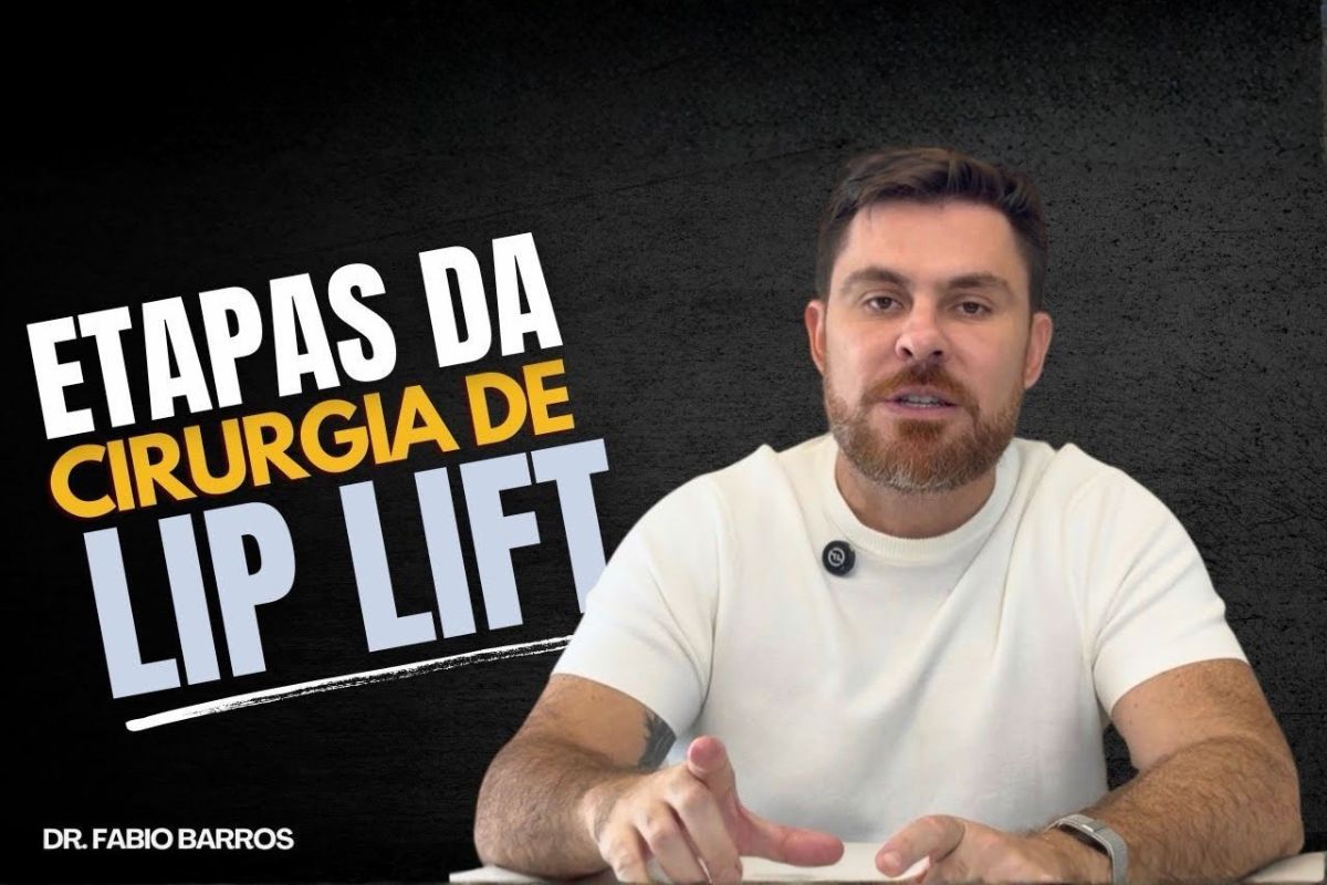 Cirurgia de lip lift: etapas, recuperação e o que esperar do procedimento