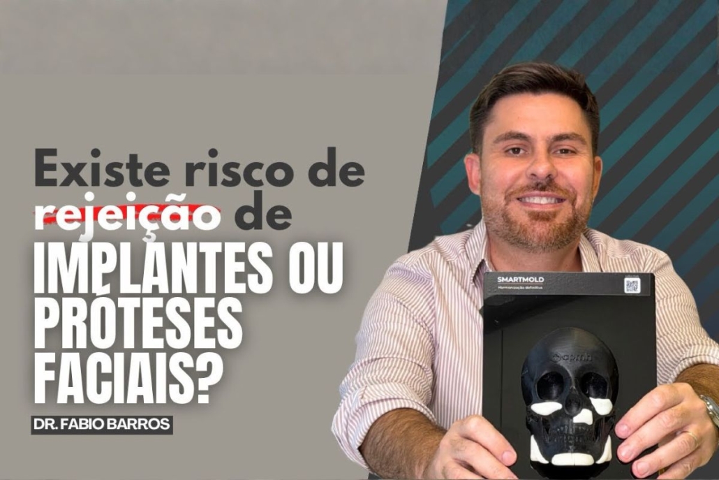 Existe risco de rejeição de implantes faciais?