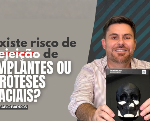 Existe risco de rejeição de implantes faciais?
