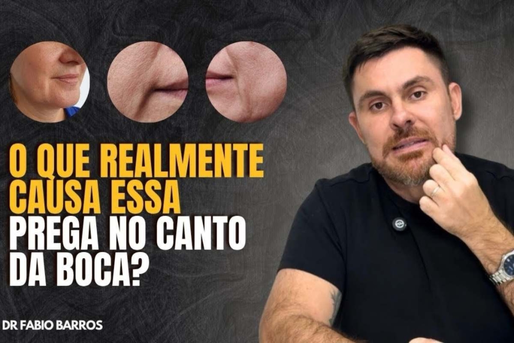 O Que Causa a Prega no Canto da Boca? Entenda a Verdadeira Origem do Problema e Como Tratar de Forma Natural