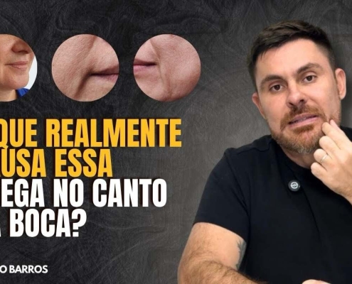 O Que Causa a Prega no Canto da Boca? Entenda a Verdadeira Origem do Problema e Como Tratar de Forma Natural