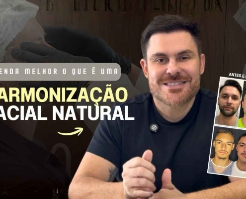 Harmonização Facial Natural: Como Ter Resultado Sem Ficar Artificial?