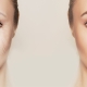 Três formas de sustentação da face