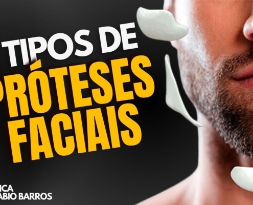 3 Tipos de Próteses Faciais: Entenda Qual é a Melhor Opção Para Você