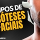 3 Tipos de Próteses Faciais: Entenda Qual é a Melhor Opção Para Você