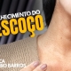 Sinais do Envelhecimento do Pescoço: Como Prevenir e Tratar