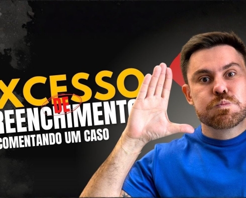 Perigo do Excesso de Preenchimento: como reconhecer, reverter e voltar ao natural