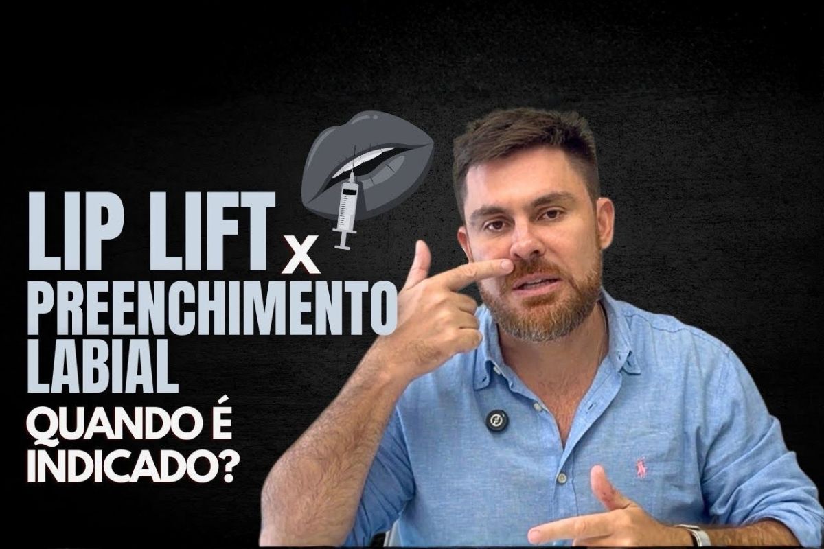 Lip lift x preenchimento labial: diferenças e quando indicar cada um