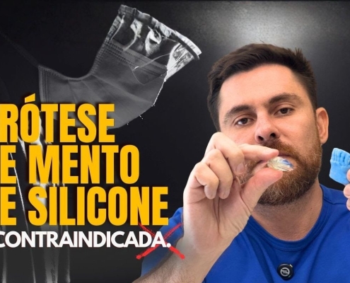 Prótese de silicone no queixo: o que pode dar errado com o tempo?